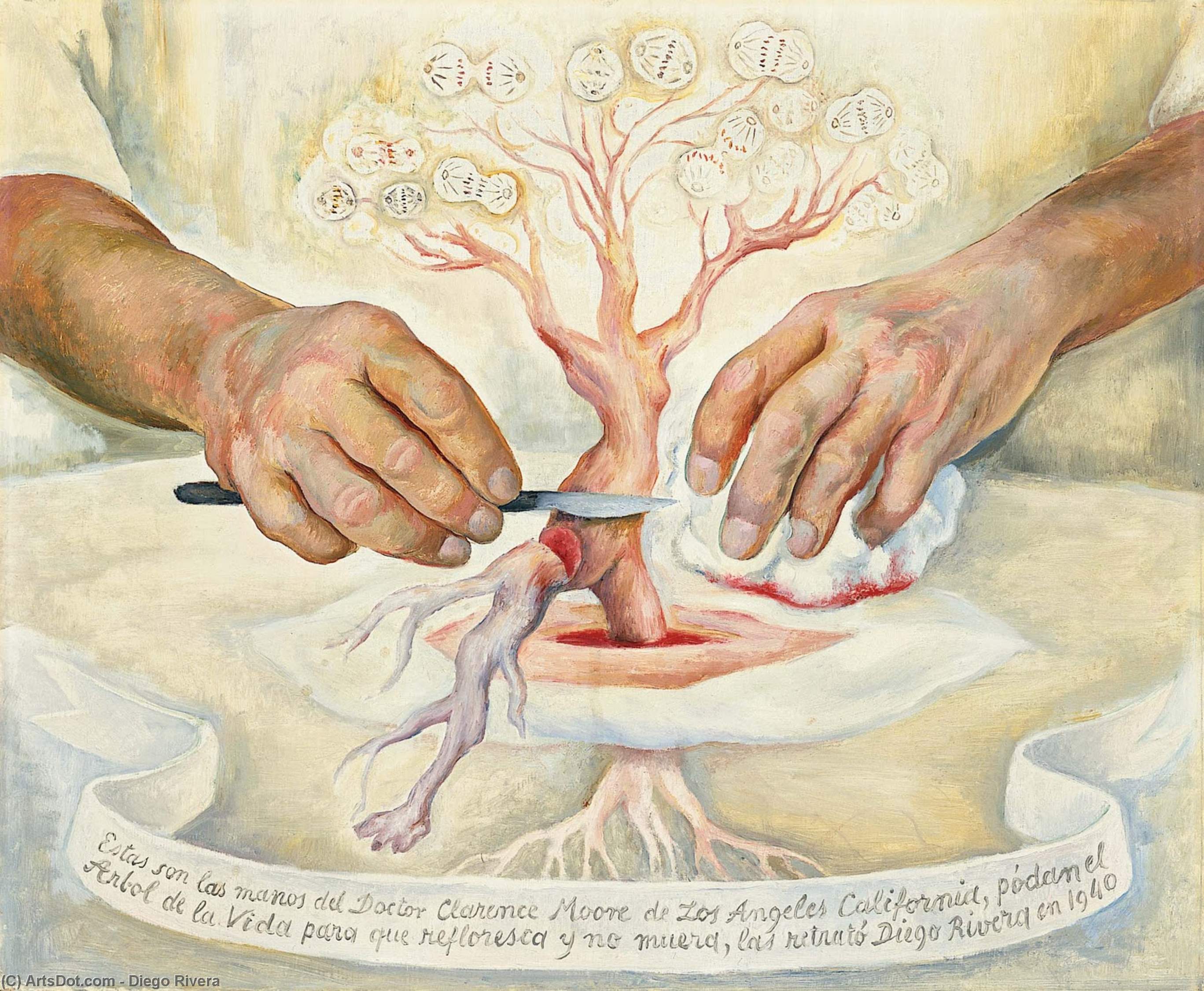 Diego Rivera - Las manos del Dr. Moore
